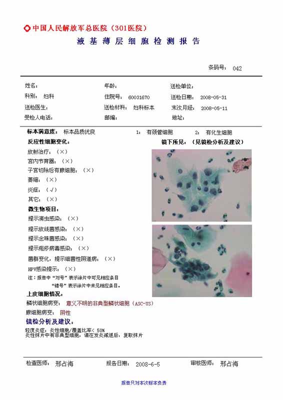 报告展示--液基细胞诊断技术|北京诚智光辉科技有限
